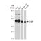 Complement C1q Binding Protein antibody, GTX02847, GeneTex, Western Blot image 