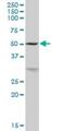 Glycerol Kinase antibody, H00002710-B01P, Novus Biologicals, Western Blot image 