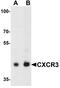 C-X-C Motif Chemokine Receptor 3 antibody, TA326704, Origene, Western Blot image 