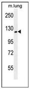 Sperm Antigen With Calponin Homology And Coiled-Coil Domains 1 Like antibody, AP51179PU-N, Origene, Western Blot image 