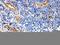 CD59 Molecule (CD59 Blood Group) antibody, RP1076, Boster Biological Technology, Immunohistochemistry paraffin image 