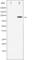 Ribosomal Protein S6 Kinase A5 antibody, abx010389, Abbexa, Western Blot image 