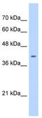 ST6 N-Acetylgalactosaminide Alpha-2,6-Sialyltransferase 6 antibody, TA341921, Origene, Western Blot image 