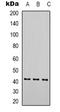 Actin Alpha 1, Skeletal Muscle antibody, LS-C413476, Lifespan Biosciences, Western Blot image 