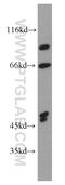 Myocardial Zonula Adherens Protein antibody, 18129-1-AP, Proteintech Group, Western Blot image 