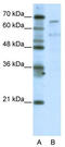 TATA-Box Binding Protein Associated Factor 6 Like antibody, TA343612, Origene, Western Blot image 