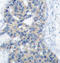 Stathmin 1 antibody, STJ22422, St John