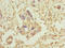 Translocase Of Outer Mitochondrial Membrane 34 antibody, LS-C676623, Lifespan Biosciences, Immunohistochemistry paraffin image 