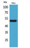 Nuclear Receptor Subfamily 1 Group H Member 3 antibody, STJ96508, St John