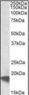 ADP Ribosylation Factor 4 antibody, orb178867, Biorbyt, Western Blot image 