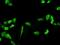 Phosphoglycerate Dehydrogenase antibody, H00026227-M01, Novus Biologicals, Immunofluorescence image 