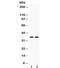 CD58 Molecule antibody, R32395, NSJ Bioreagents, Western Blot image 