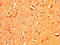 T-Box 3 antibody, LS-C672542, Lifespan Biosciences, Immunohistochemistry paraffin image 