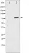 IKK alpha/beta antibody, TA325378, Origene, Western Blot image 