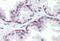 Syndecan 1 antibody, MBS242577, MyBioSource, Immunohistochemistry frozen image 