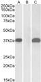ETS Transcription Factor ERG antibody, 45-549, ProSci, Western Blot image 