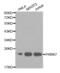 Parkinsonism Associated Deglycase antibody, abx000940, Abbexa, Western Blot image 