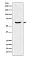 Asparagine Synthetase (Glutamine-Hydrolyzing) antibody, M03302, Boster Biological Technology, Western Blot image 