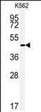 Ectonucleoside Triphosphate Diphosphohydrolase 8 antibody, PA5-25085, Invitrogen Antibodies, Western Blot image 