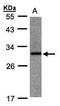 Ankyrin repeat domain-containing protein 7 antibody, GTX106843, GeneTex, Western Blot image 