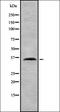 Immunoglobulin Heavy Constant Gamma 3 (G3m Marker) antibody, orb337081, Biorbyt, Western Blot image 