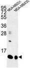 Small Proline Rich Protein 1B antibody, GTX80592, GeneTex, Western Blot image 