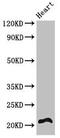 Regulator Of Calcineurin 2 antibody, CSB-PA618879LA01HU, Cusabio, Western Blot image 