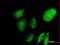 Nascent polypeptide-associated complex subunit alpha antibody, H00004666-B01P, Novus Biologicals, Immunocytochemistry image 