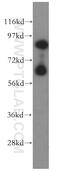 Tax1 Binding Protein 1 antibody, 14424-1-AP, Proteintech Group, Western Blot image 