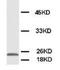 Phosphomevalonate Kinase antibody, AP23367PU-N, Origene, Western Blot image 
