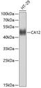 Carbonic Anhydrase 12 antibody, 13-485, ProSci, Western Blot image 