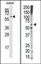 Transforming Growth Factor Beta Receptor 1 antibody, AP14647PU-N, Origene, Western Blot image 