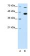 Zinc Finger And BTB Domain Containing 33 antibody, orb324770, Biorbyt, Western Blot image 