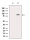 DEAD-Box Helicase 17 antibody, GTX02534, GeneTex, Western Blot image 