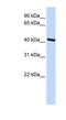 Tropomodulin 3 antibody, NBP1-56652, Novus Biologicals, Western Blot image 