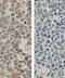 Hematopoietic Cell-Specific Lyn Substrate 1 antibody, orb77142, Biorbyt, Immunohistochemistry paraffin image 