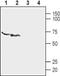 Purinergic Receptor P2X 6 antibody, PA5-77684, Invitrogen Antibodies, Western Blot image 