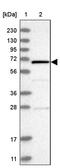 REC8 Meiotic Recombination Protein antibody, PA5-56835, Invitrogen Antibodies, Western Blot image 