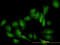 Galectin 1 antibody, LS-C197613, Lifespan Biosciences, Immunofluorescence image 