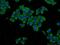 Glutathione S-Transferase Theta 2 (Gene/Pseudogene) antibody, 15063-1-AP, Proteintech Group, Immunofluorescence image 