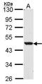 Nuclear Receptor Subfamily 1 Group H Member 2 antibody, GTX104800, GeneTex, Western Blot image 