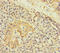 Alpha-1,4-N-Acetylglucosaminyltransferase antibody, orb20077, Biorbyt, Immunohistochemistry paraffin image 
