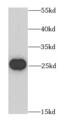 BCAS2 Pre-MRNA Processing Factor antibody, FNab00828, FineTest, Western Blot image 