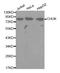 Component Of Inhibitor Of Nuclear Factor Kappa B Kinase Complex antibody, abx123406, Abbexa, Western Blot image 