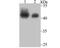 SWI/SNF Related, Matrix Associated, Actin Dependent Regulator Of Chromatin, Subfamily B, Member 1 antibody, A00500-1, Boster Biological Technology, Western Blot image 