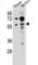 Tripartite Motif Containing 62 antibody, abx027323, Abbexa, Western Blot image 