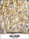 Hyaluronan Binding Protein 2 antibody, 62-002, ProSci, Immunohistochemistry frozen image 