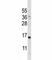 Parathyroid Hormone antibody, F43171-0.4ML, NSJ Bioreagents, Western Blot image 