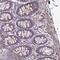 BEN Domain Containing 5 antibody, PA5-63507, Invitrogen Antibodies, Immunohistochemistry frozen image 