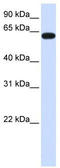 Heparan Sulfate 6-O-Sulfotransferase 3 antibody, TA330988, Origene, Western Blot image 